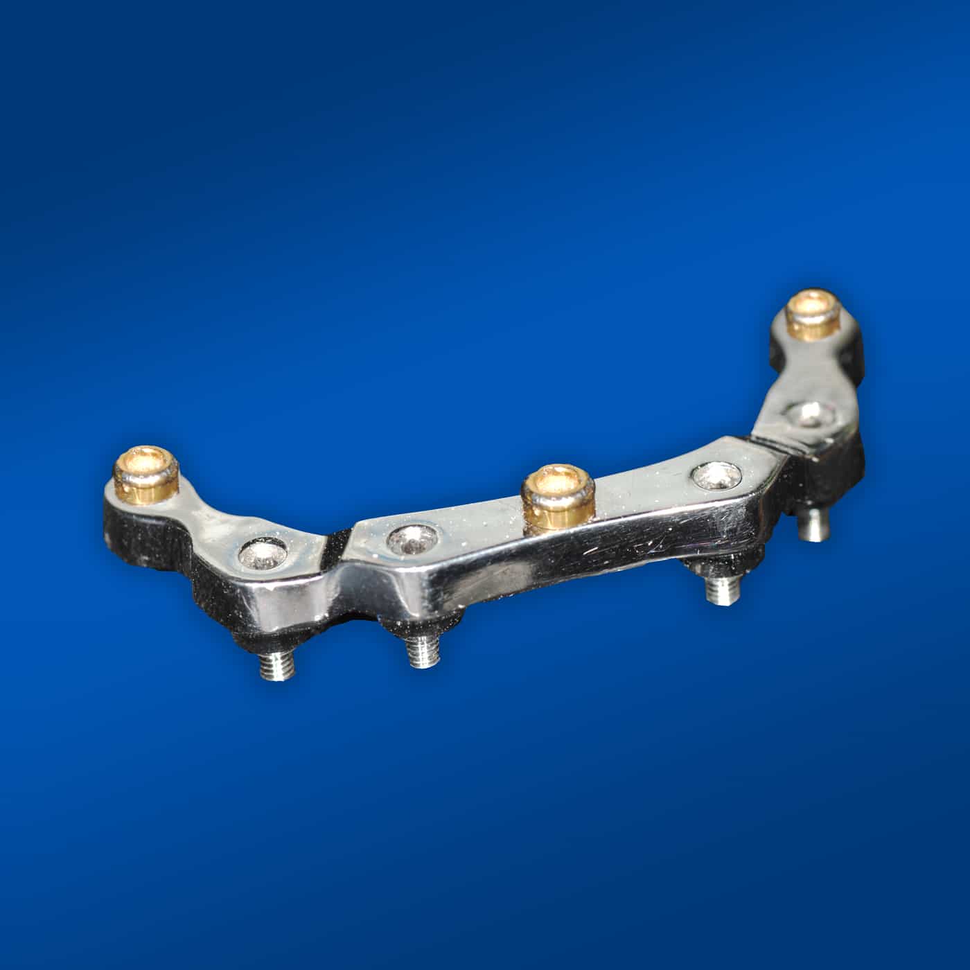 Burbank Dental Lab locator bar for denture over implant