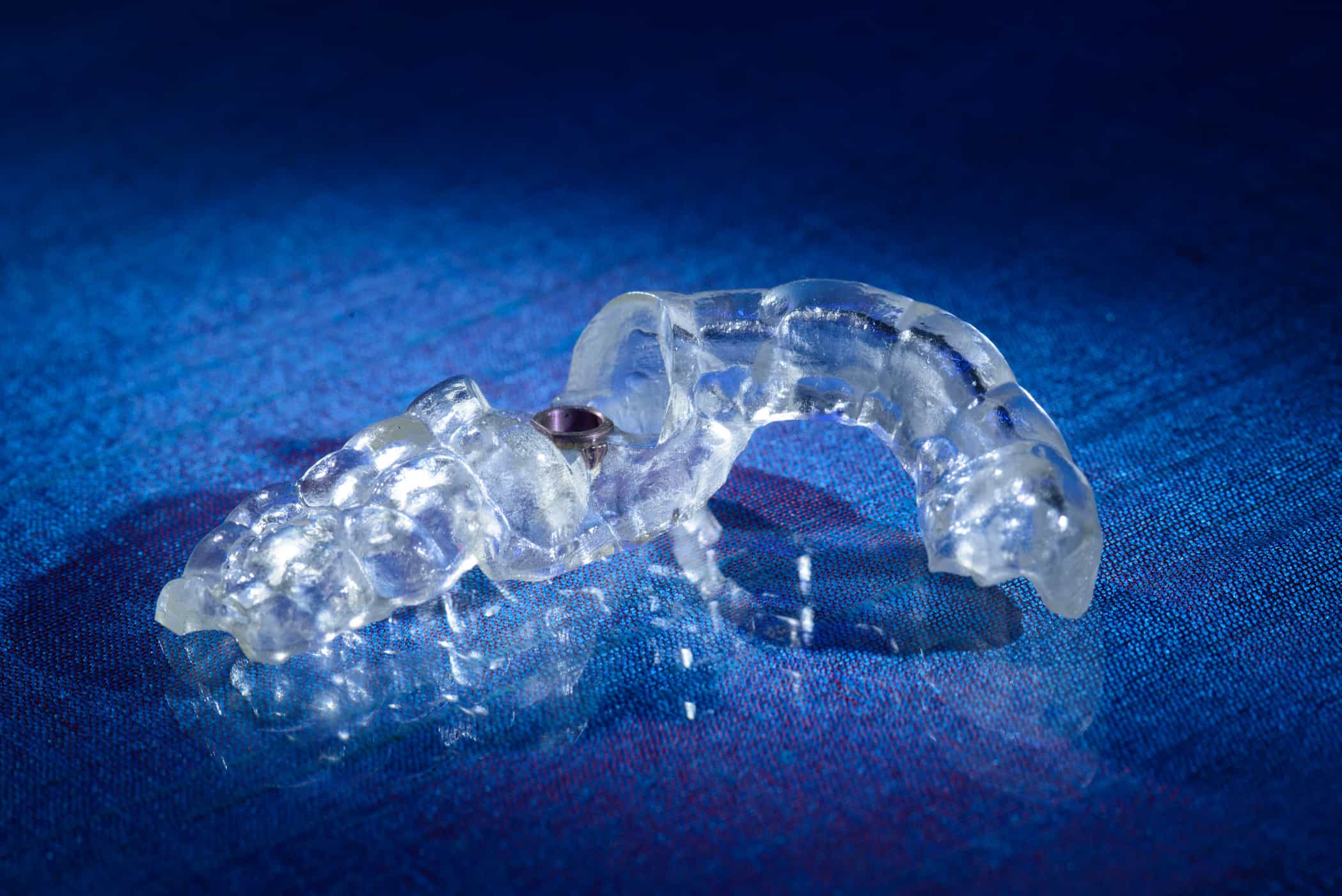 Guided Surgery Appliance created by Burbank Dental Lab