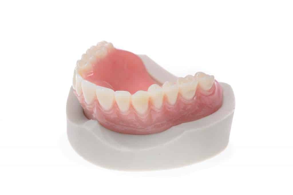 Full dentures created by Burbank Dental Lab