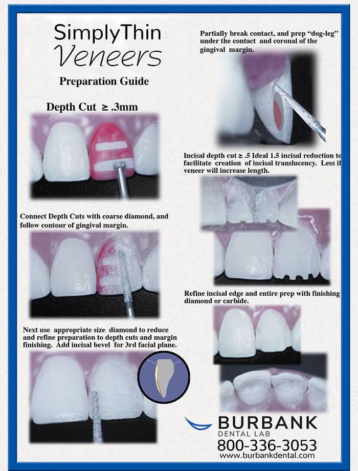 SimplyThin Veneers prep guide from Burbank Dental Lab