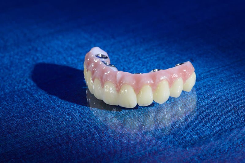 Zir-MAX Zirconia from Burbank Dental Lab