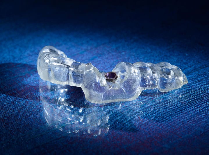 Guided surgery appliance from Burbank Dental Lab