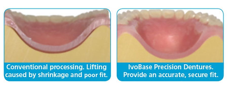 IvoBase illustration