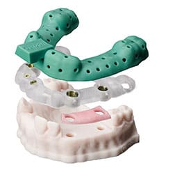 Carbon Dental Parts - Burbank Dental Lab