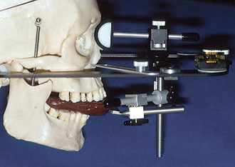 Burbank Dental Lab - Kois Bow instructions