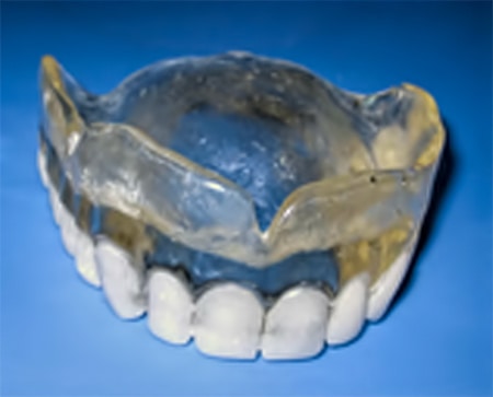 Barium Sulfate Scanning Guide - Burbank Dental Lab
