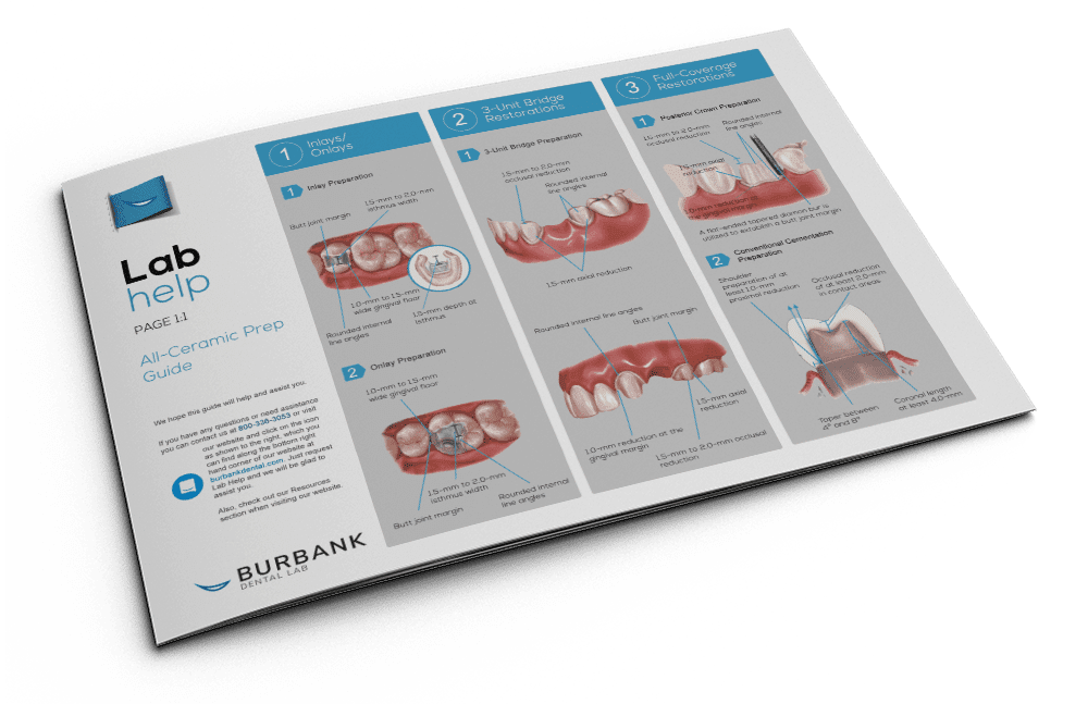All-Ceramic Prep Guide