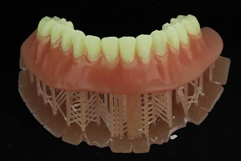 Printed and milled denture prosthesis