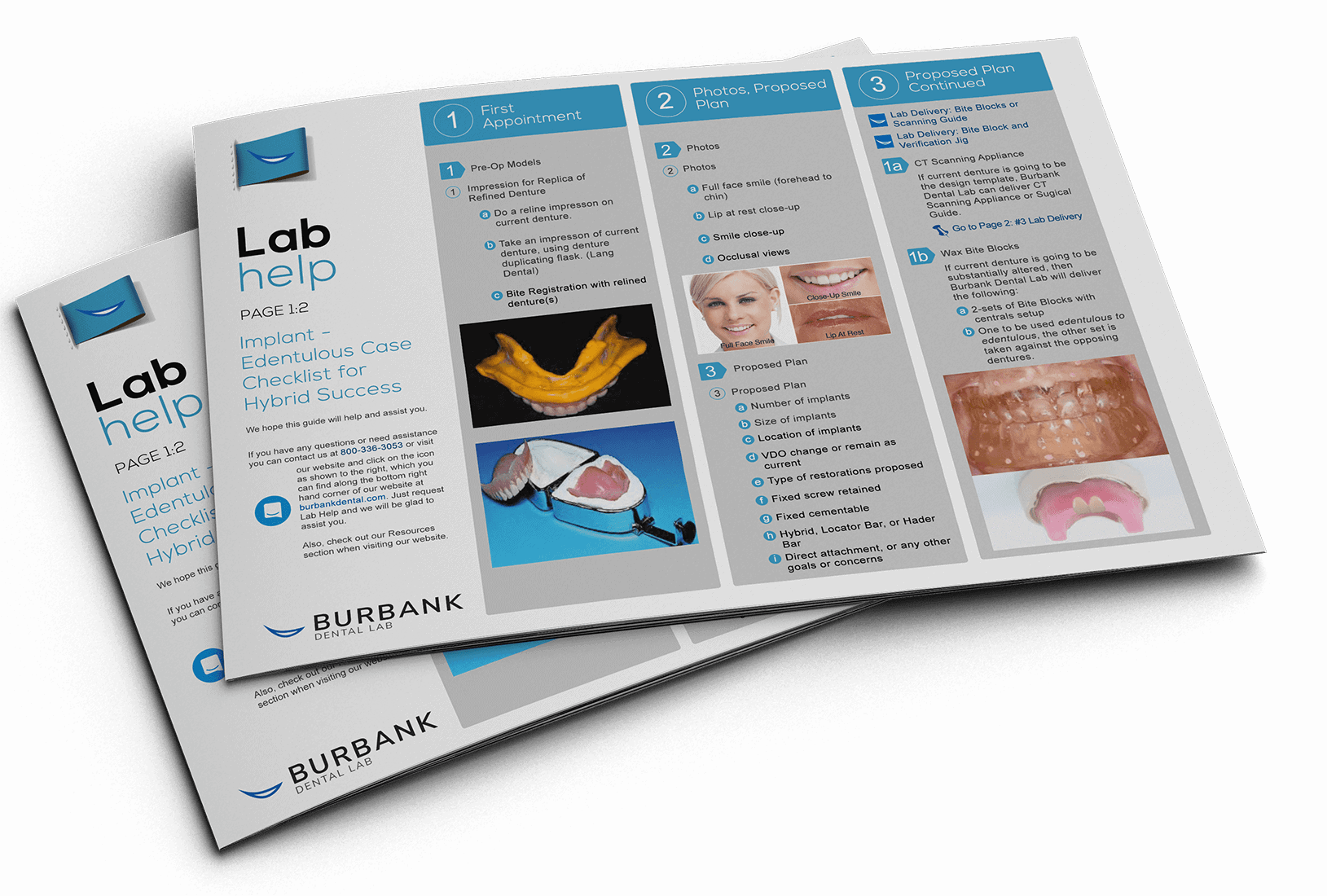 Implant Success Guide by Burbank Dental Lab