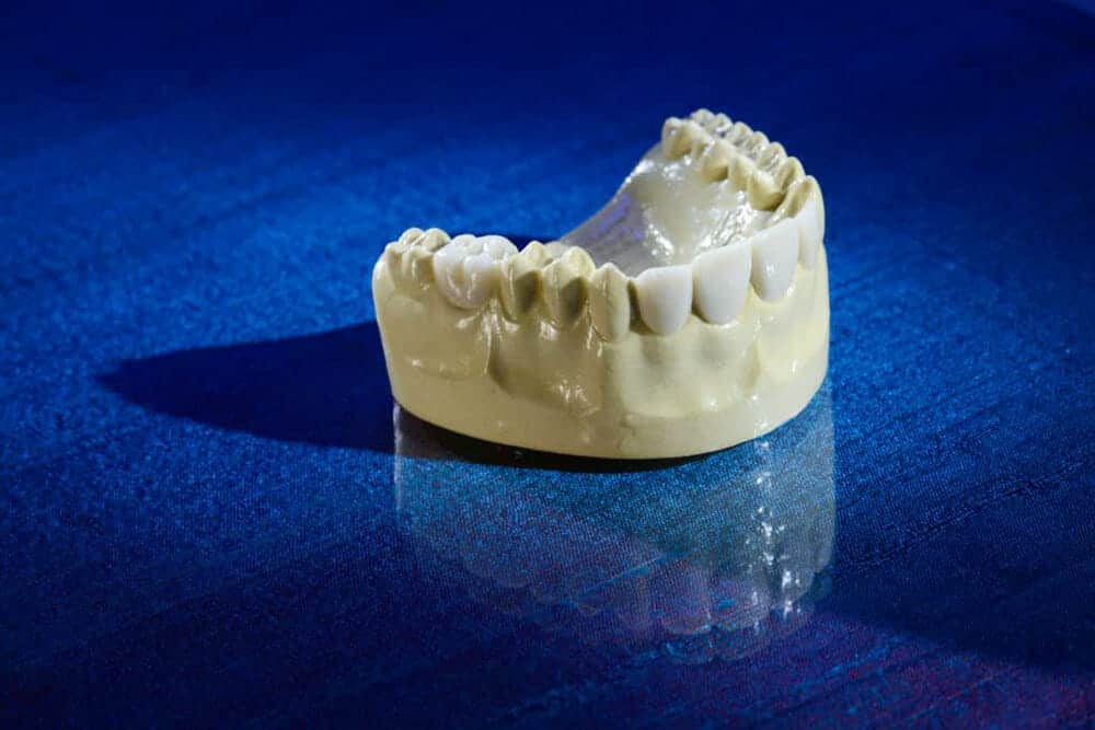 Diagnostic wax-ups from Burbank Dental Lab