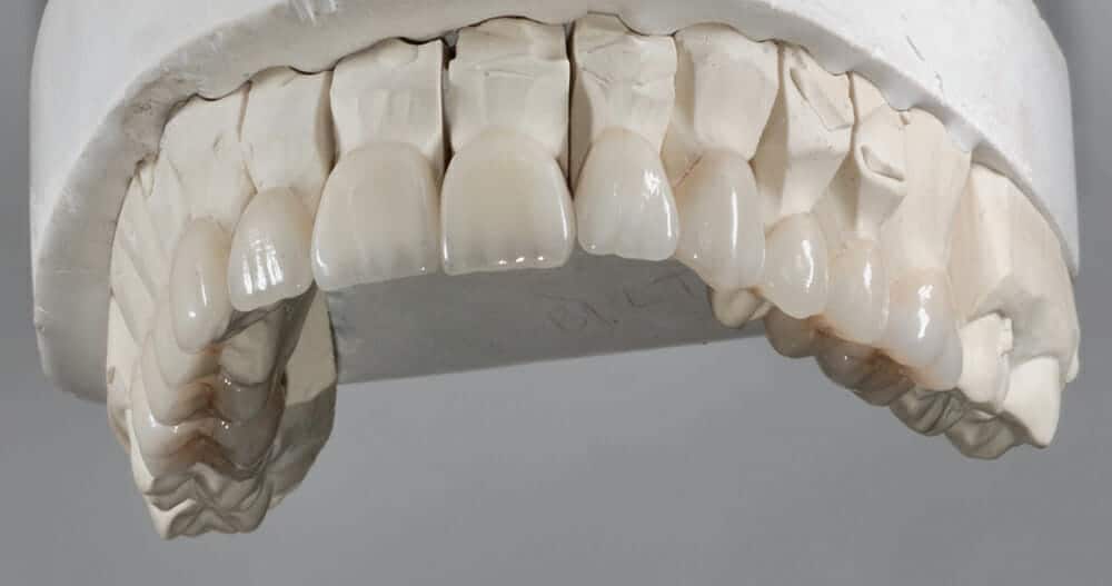 Figure 4 - Burbank Dental Lab