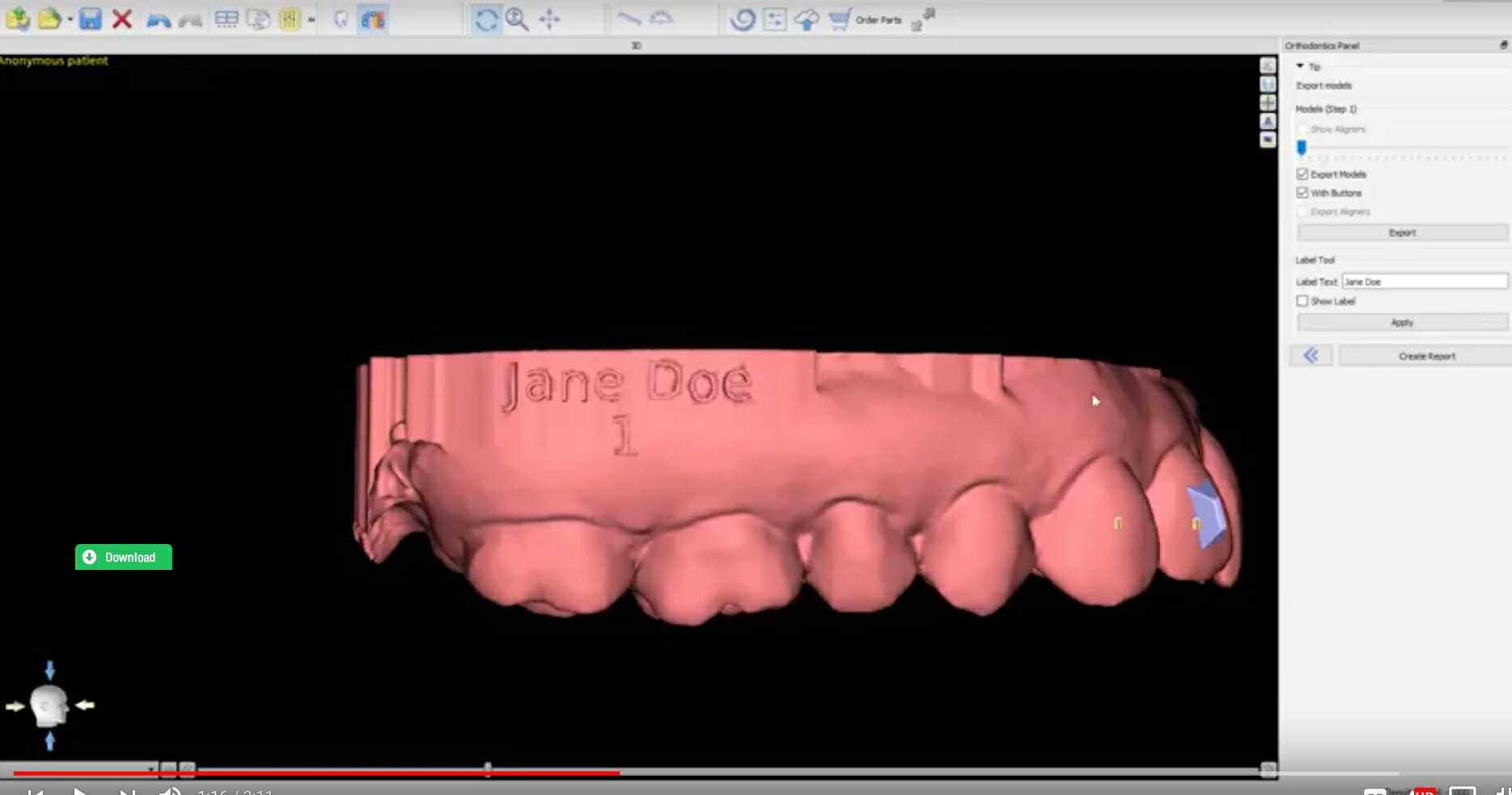 Invisible Orthodontic Aligners - Burbank Dental Lab