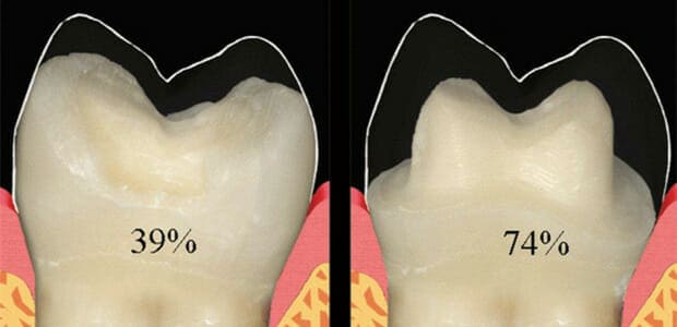 Minimally Invasive Dentistry Burbank Dental Lab