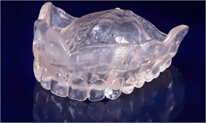 Duplicate of Current Denture Step