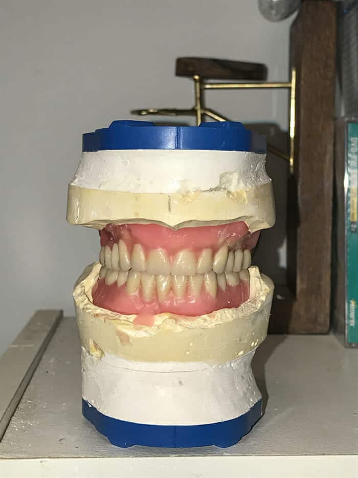 SmartComposite Hybrid - Burbank Dental Lab