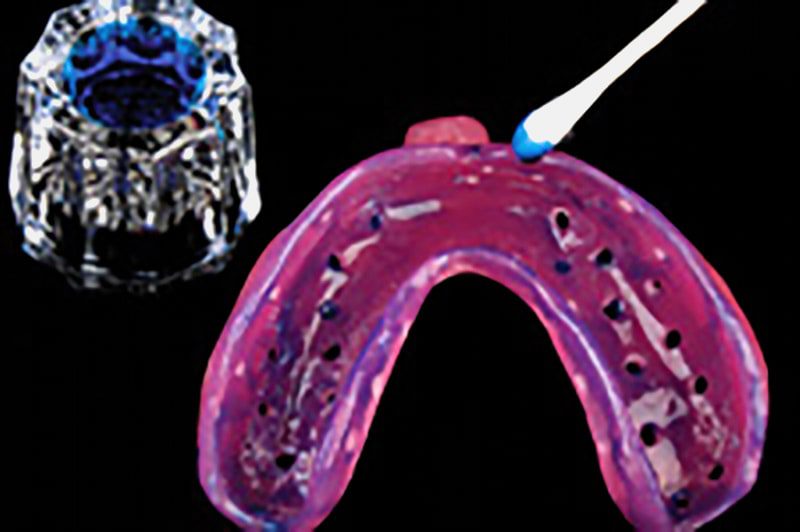 Talon™ Occlusal Splints & Splint Success Guide Burbank Dental Lab