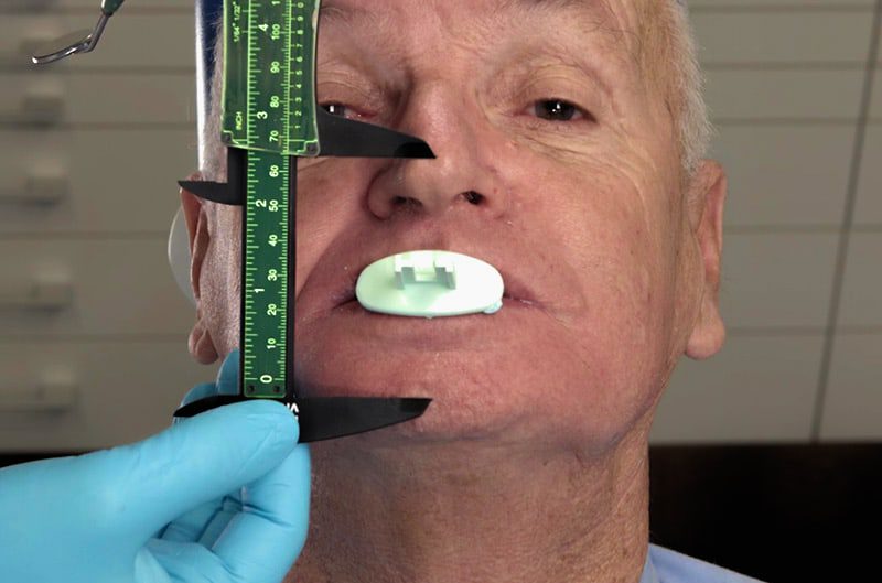 Centric trap physiologic VDO