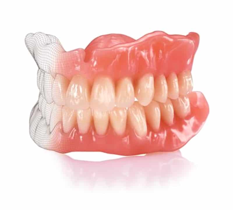 Dentures In Only 3 Appointments - Burbank Dental Lab