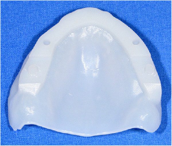 Lab designs and fabricates 3D Bite Plate - Fig. 13