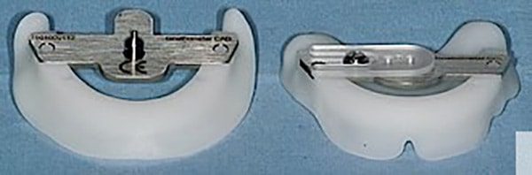 Lab designs and fabricates 3D Bite Plate - Fig. 14