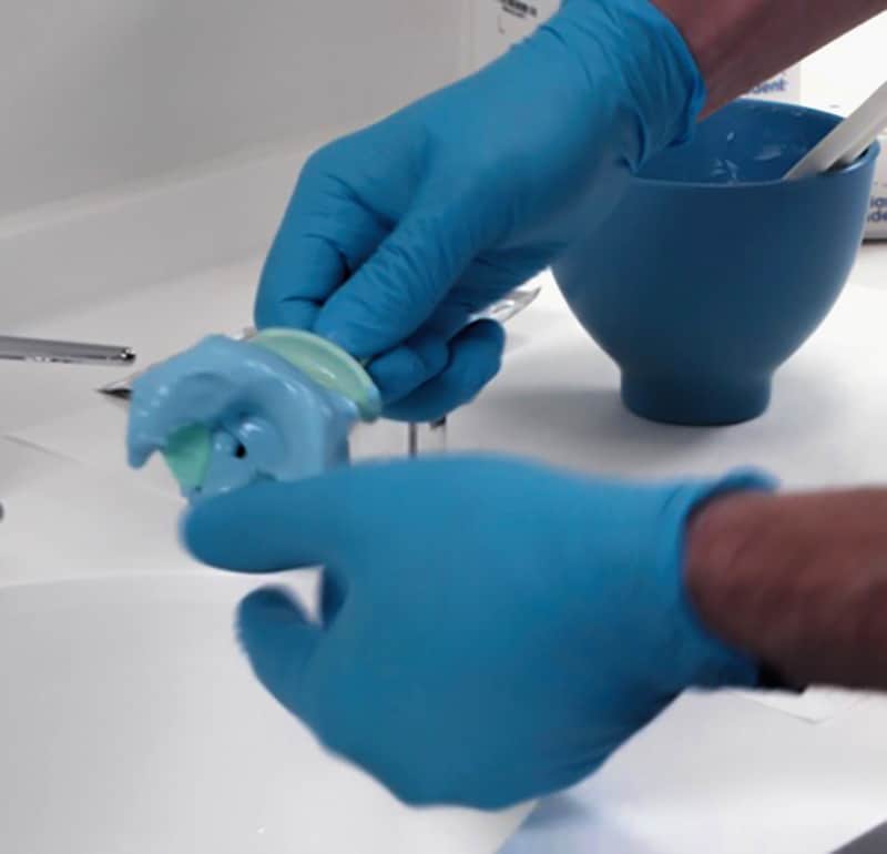Ivoclar Digital Denture Workflow For Success - Burbank Dental Lab