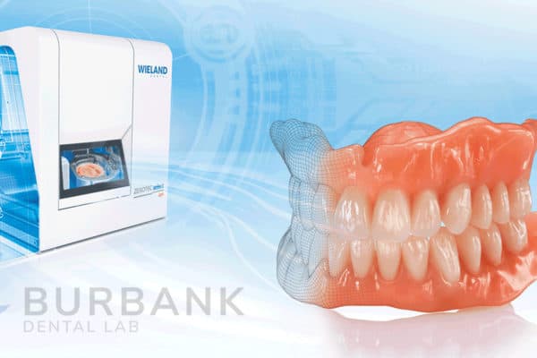 The Traditional Workflow For Edentulous Implant Cases - Burbank Dental