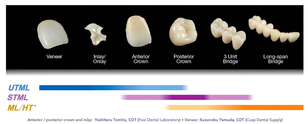 UTML - Inlay & Onlays, anterior crowns, Posterior crowns