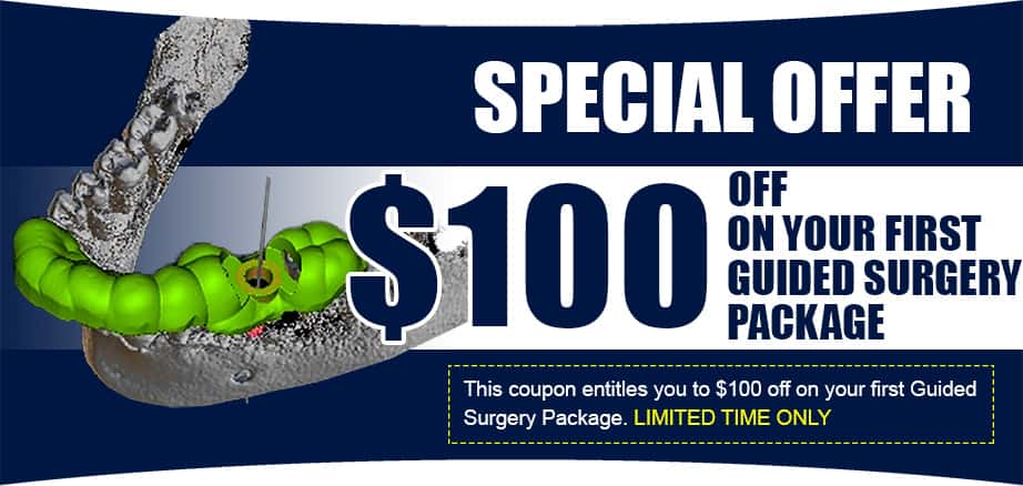 burbank-dental-lab-special-offer-guided-surgery-pckg First Guided Surgery Package Special Offer