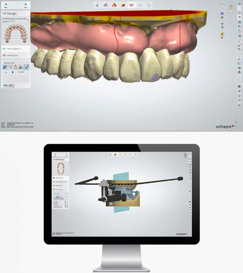 CAD-CAM Design - Ivoclar Digital Denture