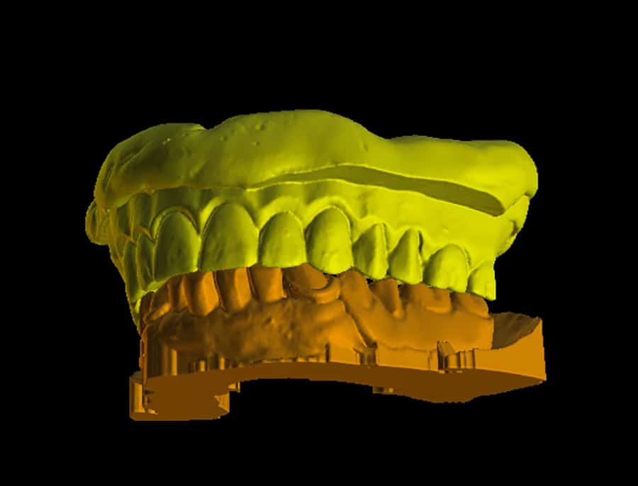 Articulated denture scans