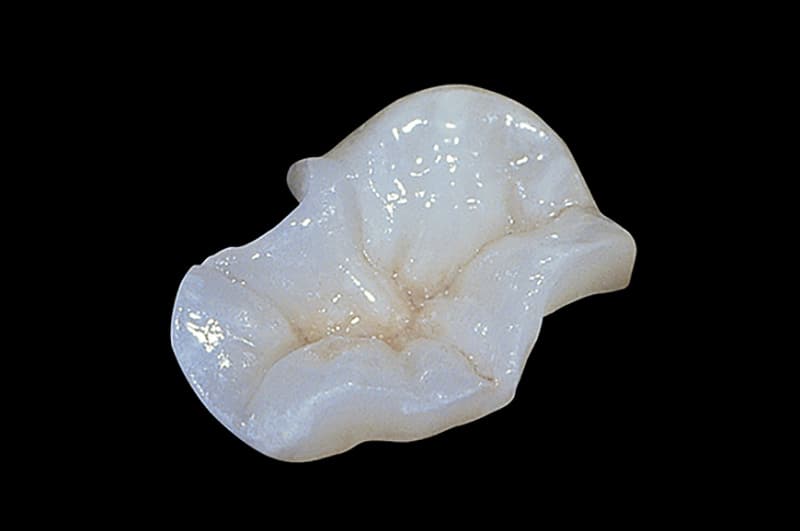 e max press third - fig. 2