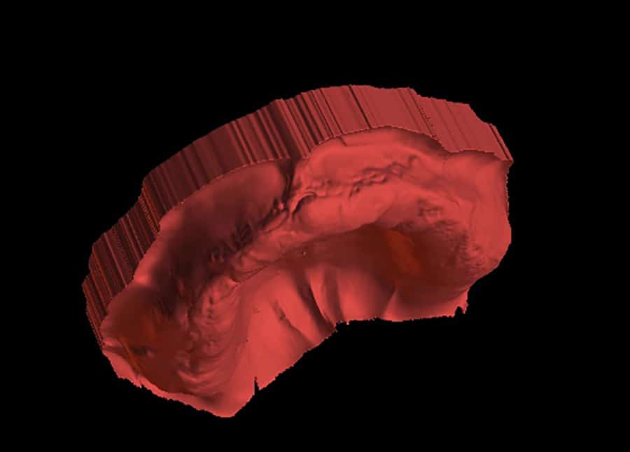Invereted model of a digital scan denture