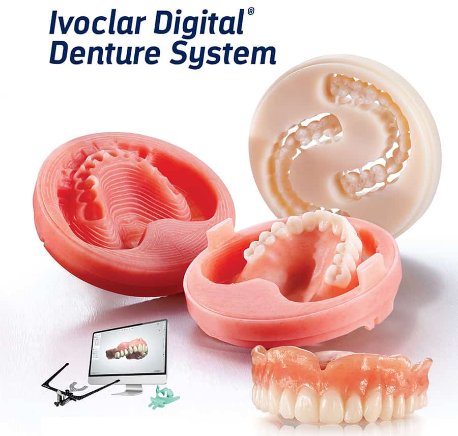 Ivoclar Digital Denture System by Burbank Dental Lab