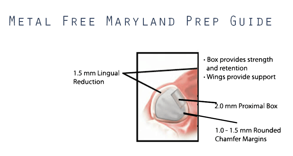 Metal Free Maryland Prep Guide - Fig. 4