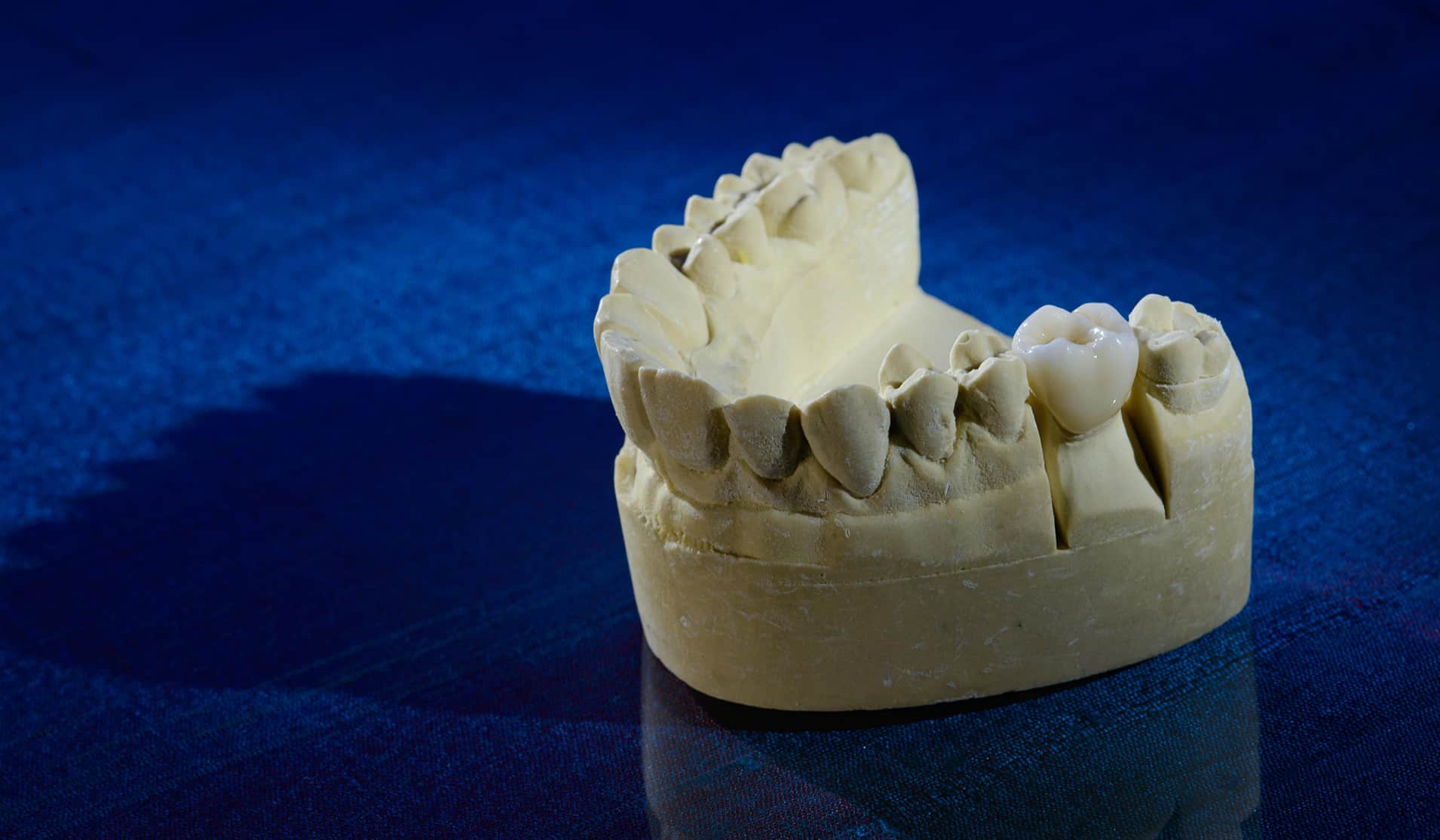 ZIRMAX M - Burbank Dental Lab CA