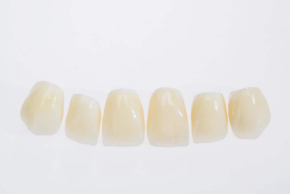 IPS e-max Crowns