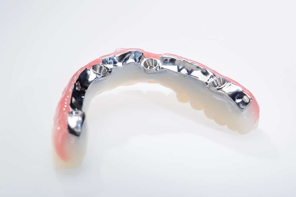 IPS e.max restorations - Burbank Dental Lab