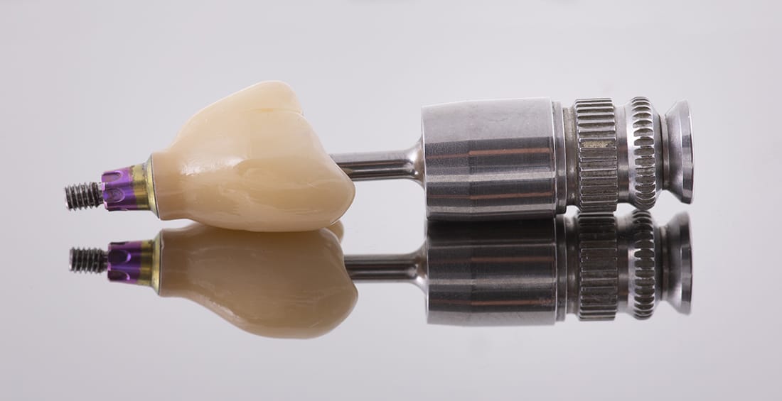 cement-retained implant restorations