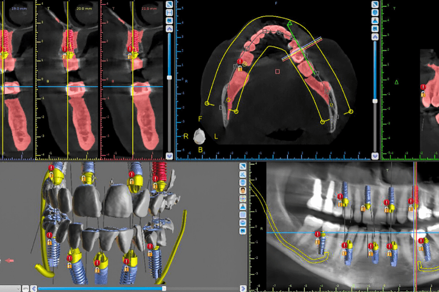 Digital Workflow - Getting Started with Digital Dentistry