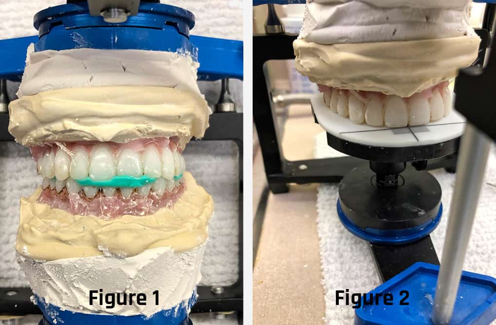 PMMA - Temporary Models