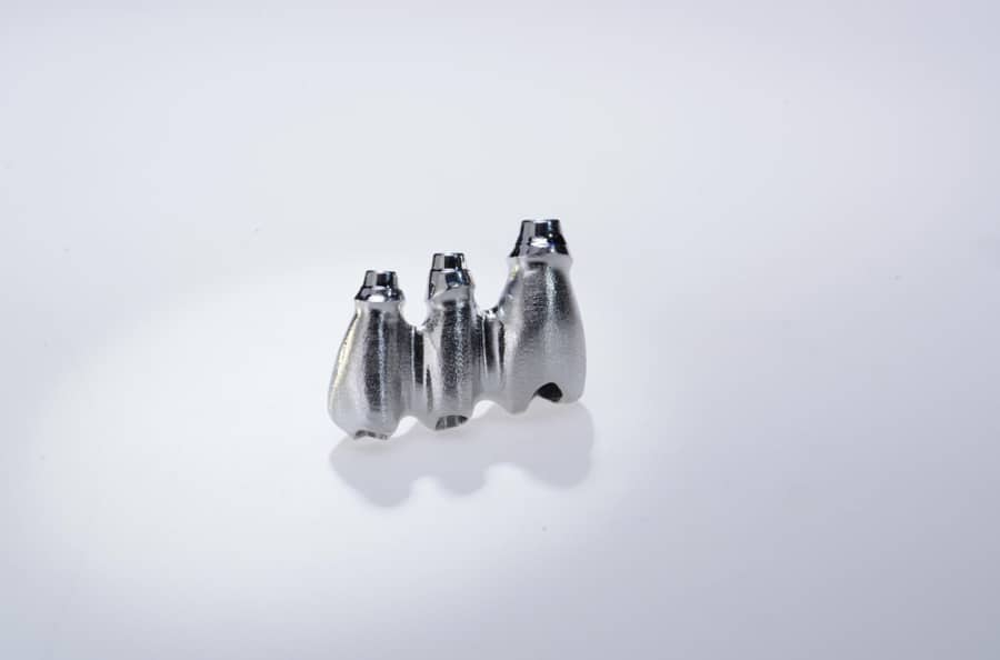 Precision Manufacturing: Single-Unit Implant