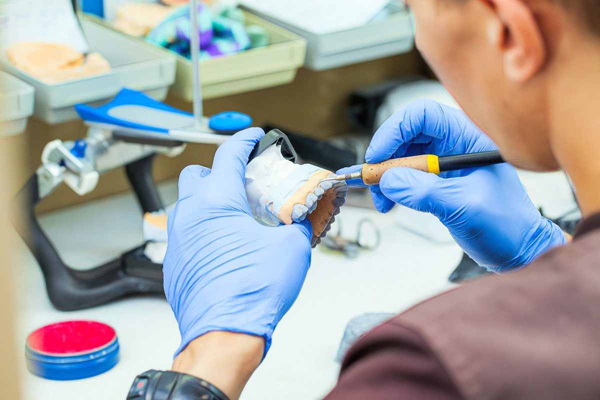 Diagnostic Wax Up - Burbank Dental Lab