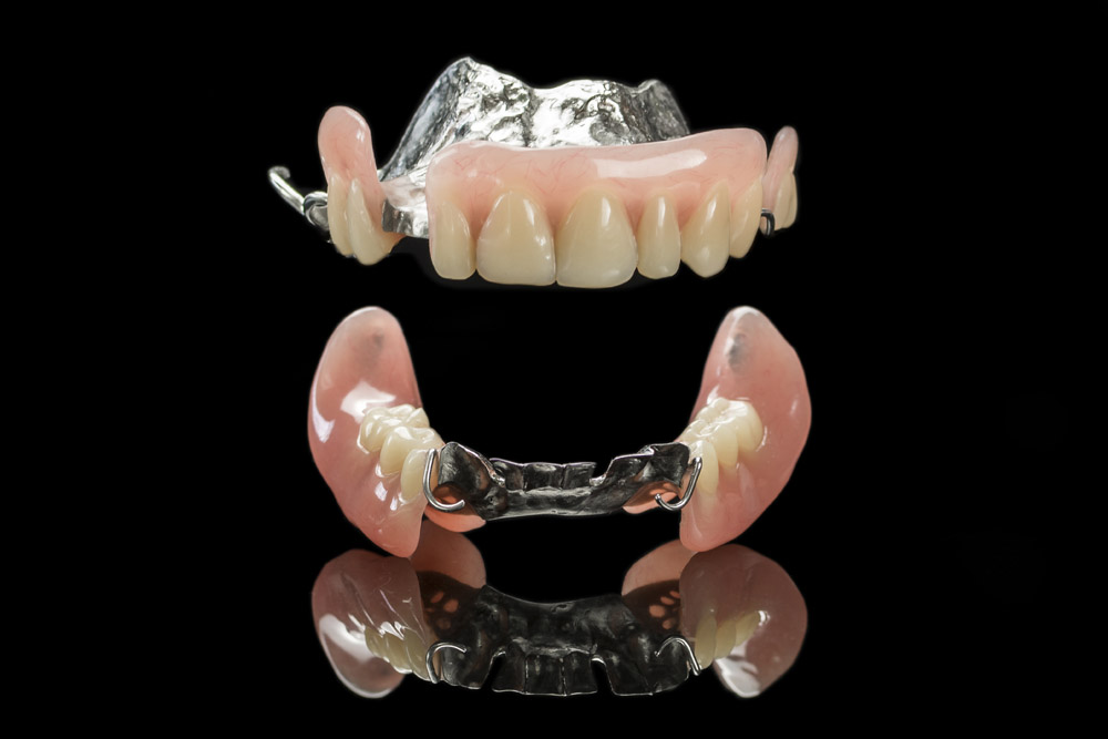 Edentulism: Finding the Perfect Fit with Partial Dentures