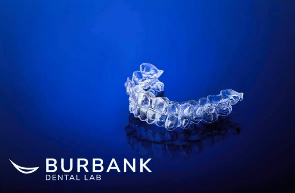 Clear Aligners at Burbank Dental Lab