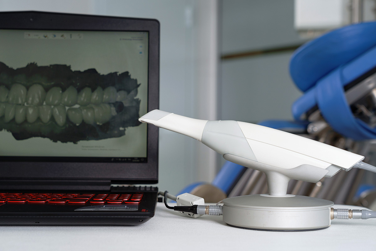 Intraoral scanner - Burbank Dental Lab