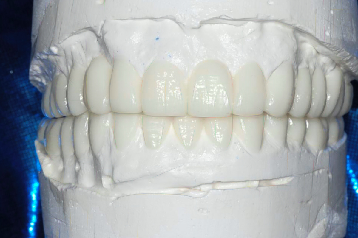 Smiles By Design - Dental Lab California