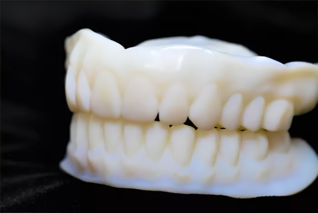 Denture Technology - Digital Dentures - Ivoclar - Burbank Dental Lab Los Angeles