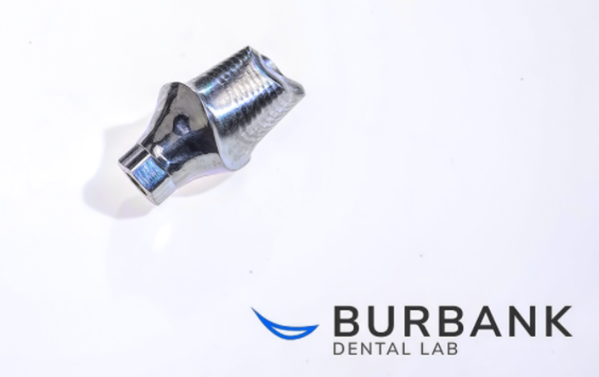 SMART 1 Implant Abutments - Burbank Dental Lab - Burbank - Los Angeles