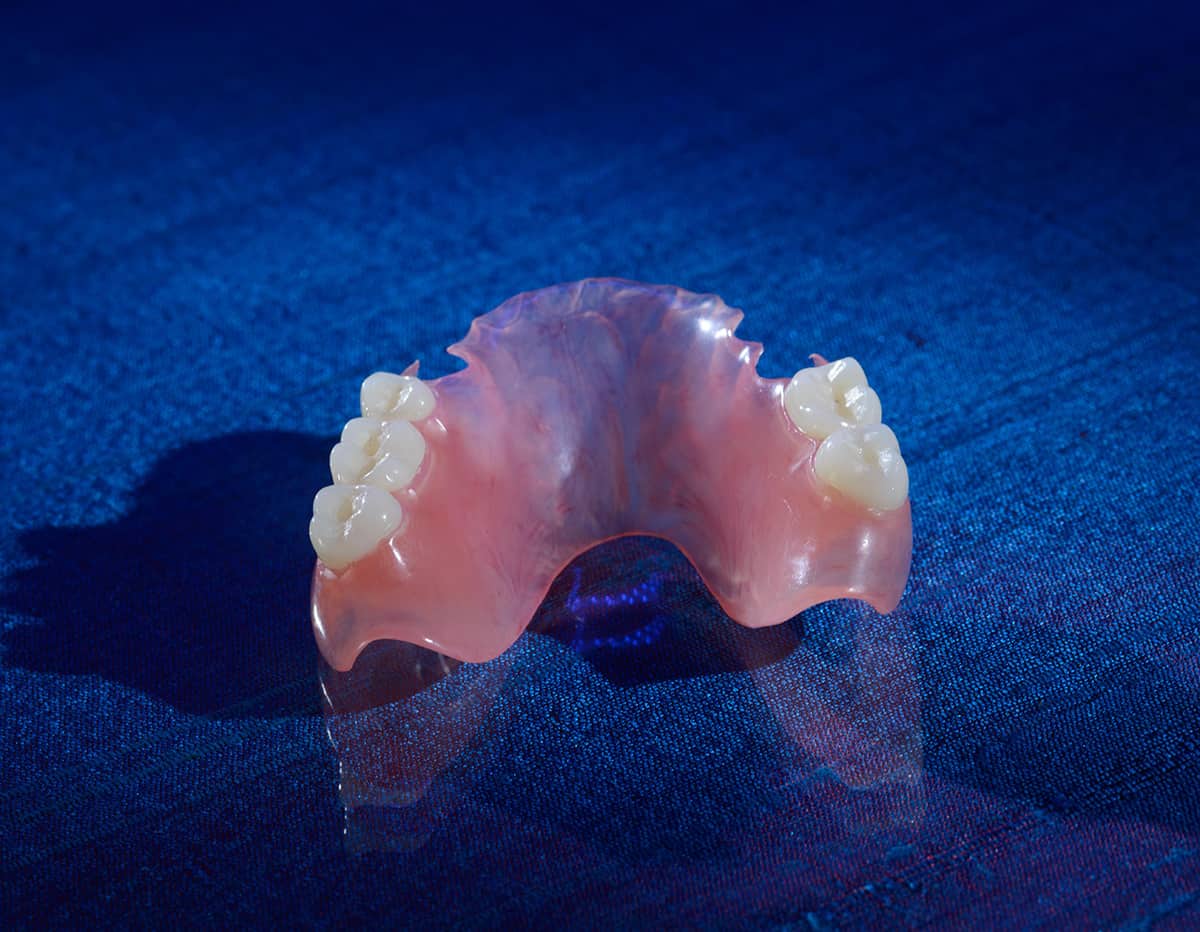 Valplast Partial Dentures - Burbank Dental Lab