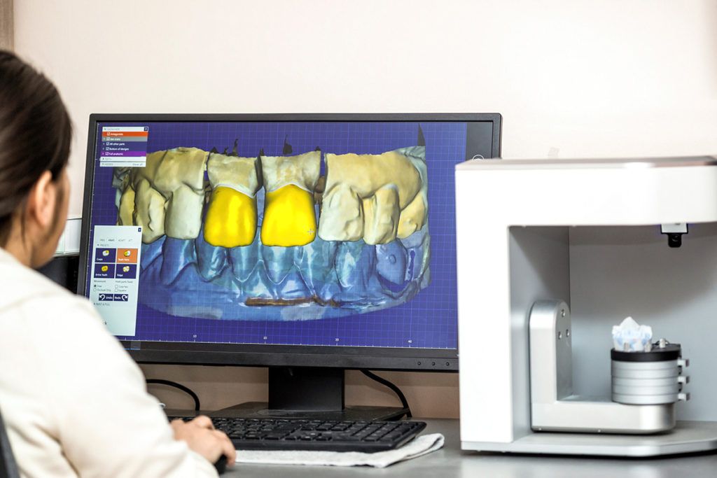 Digital Dentistry: Starting with An Intraoral Scanner